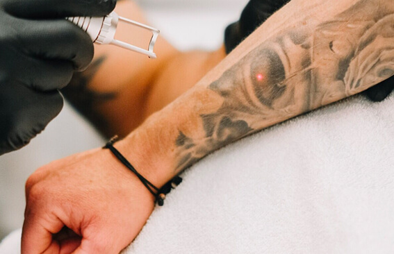 Inside the White Diamond Laser tattoo removal clinic, Gold Coast