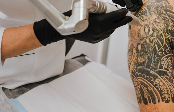 Laser tattoo removal treatment room at White Diamond Laser