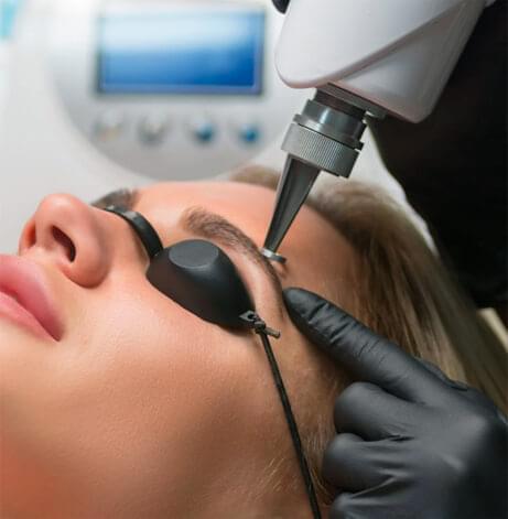 Cosmetic tattoo removal for eyebrows and lips